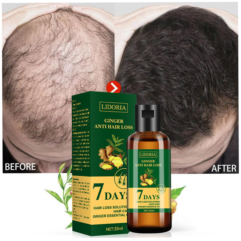 Hair Care Essence Oil - Ginger Hair Growth Essential Oil Natural