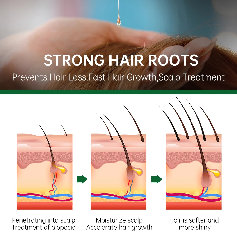 PURC Rosemary Oil for Hair Gro - Hair Care Essence Oil のレビューと価格