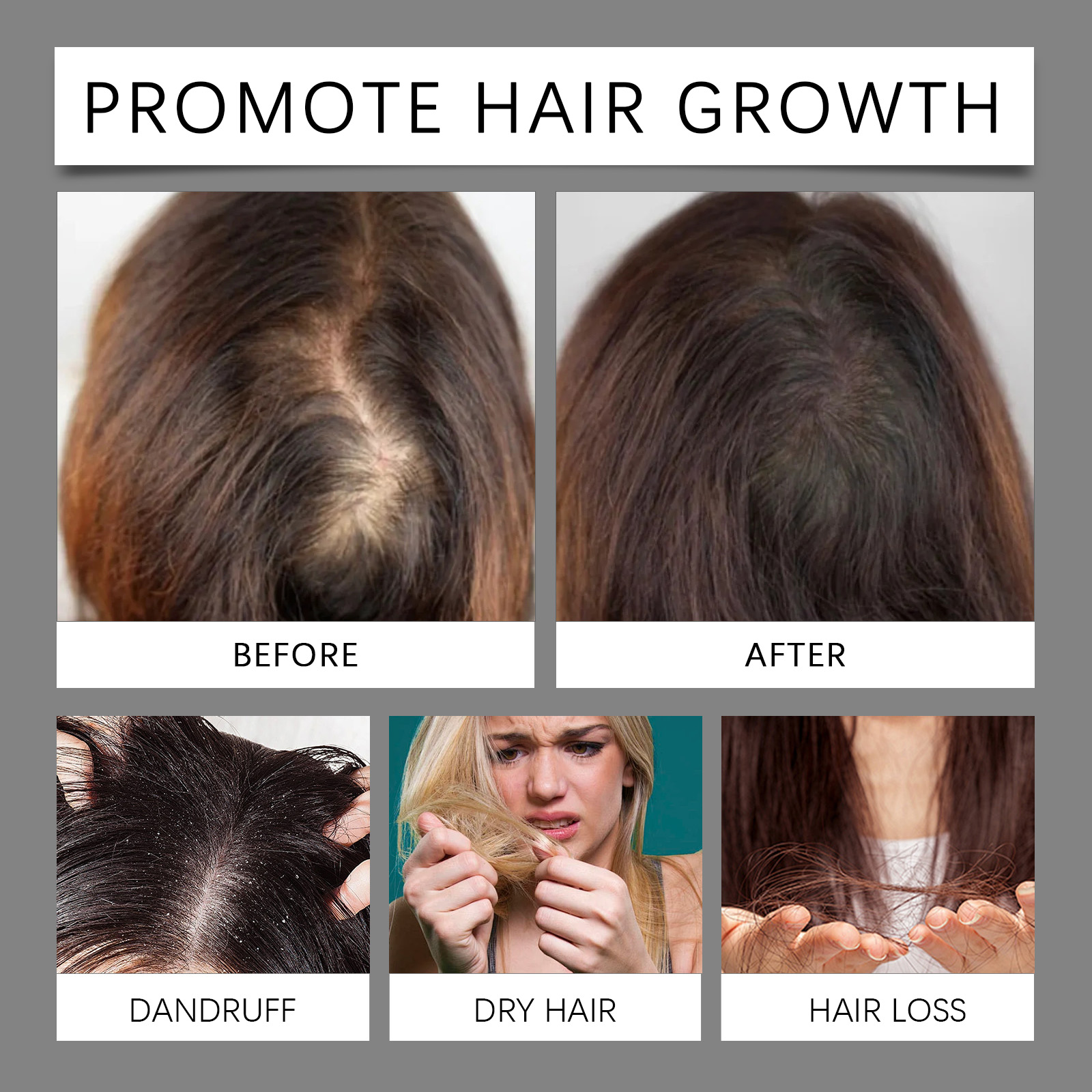 30ml Hair Care Essential Oil T - Hair Care Essence Oil のレビューと価格