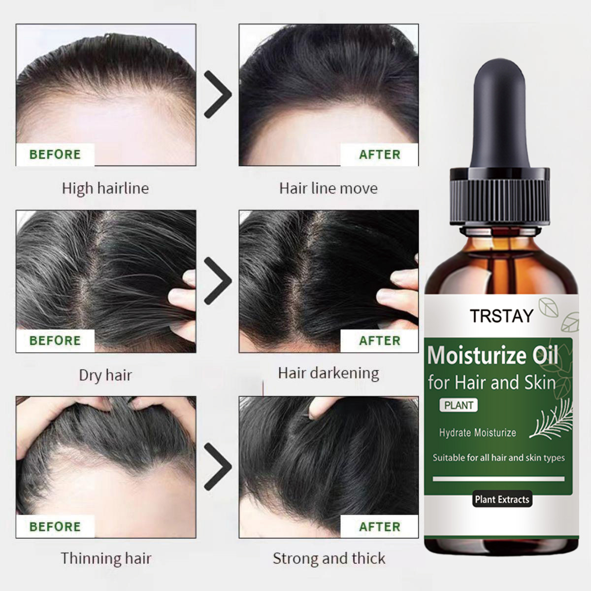 TRSTAY Rosemary Essential Oil  - Rosemary Hair Oil のレビューと価格