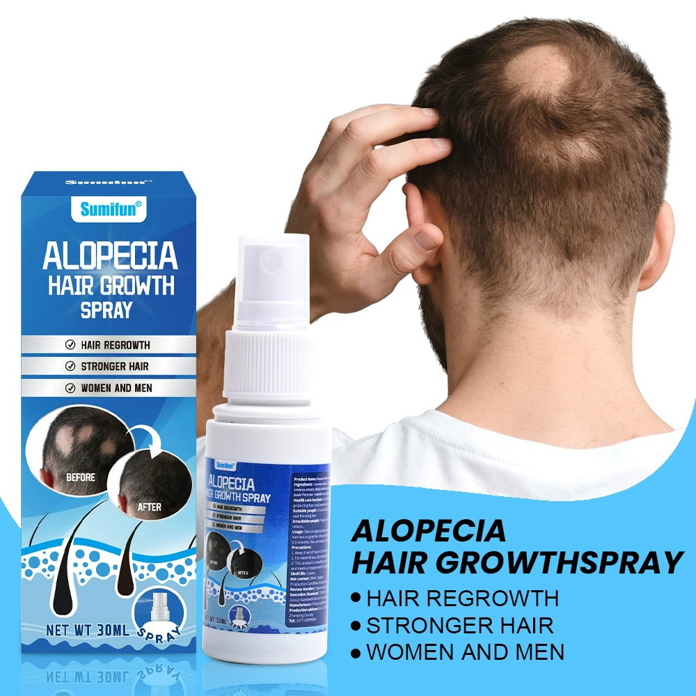 Alopecia Hair Growth Spray Sop - Hair Care Growth のレビューと価格