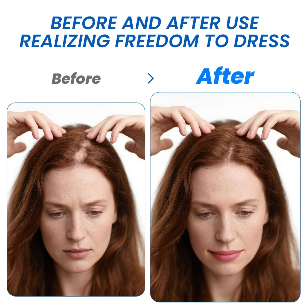 Alopecia Hair Growth Spray Sop - Hair Care Growth のレビューと価格