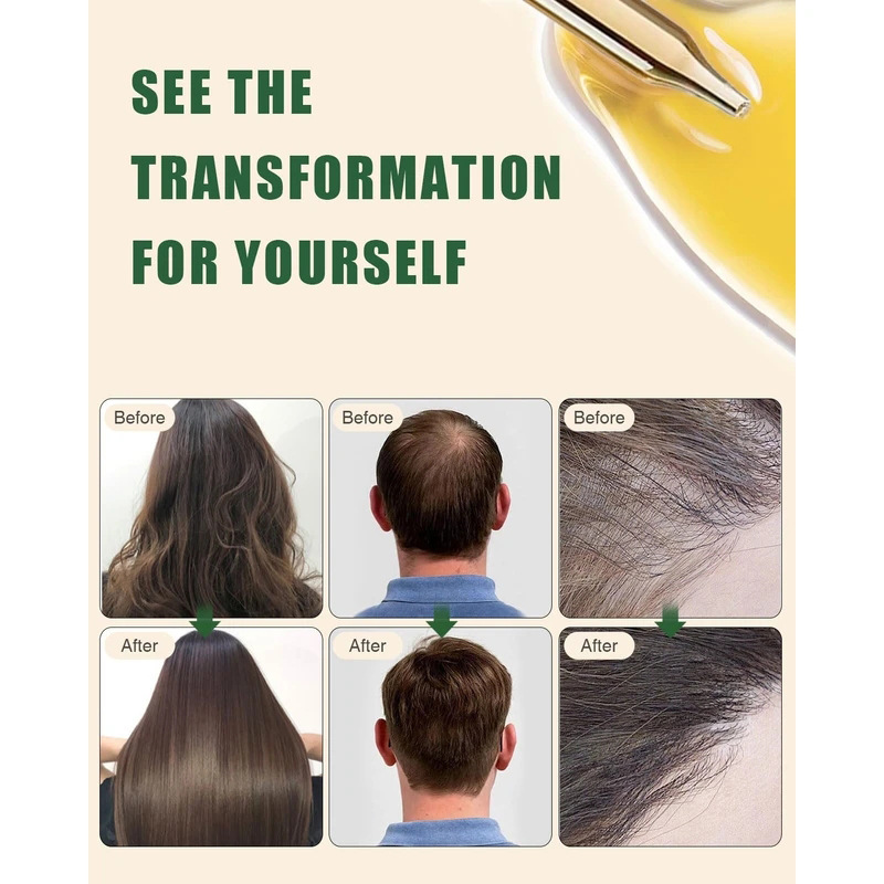 Batana Rosemary Hair Care Esse - Rosemary Hair Oil のレビューと価格
