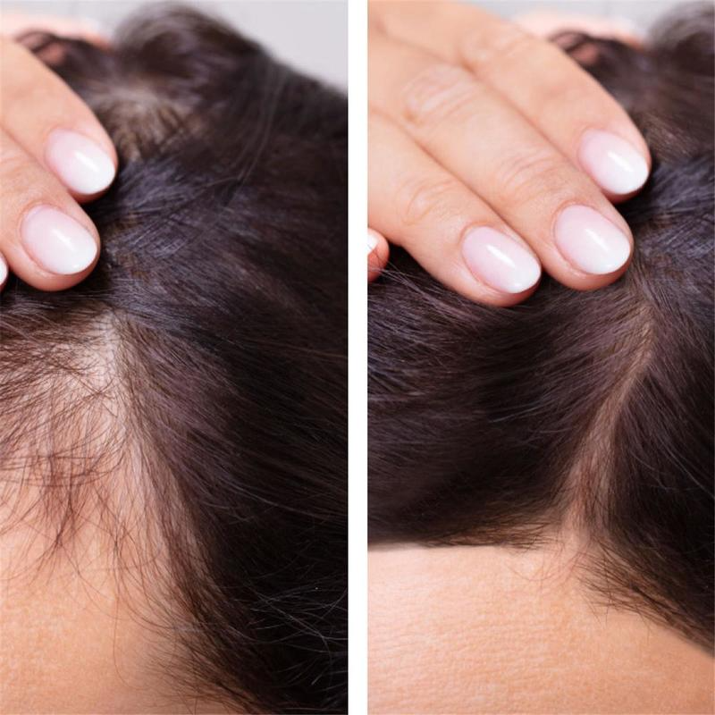 Ginger Hair Growth Essential O - Hair Care Essence Oil のレビューと価格
