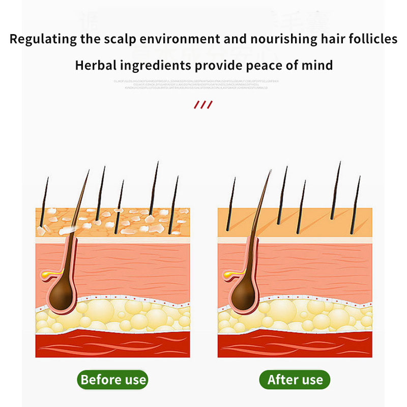 Sophora Flavescens Hair Follic - Hair Care Oil のレビューと価格