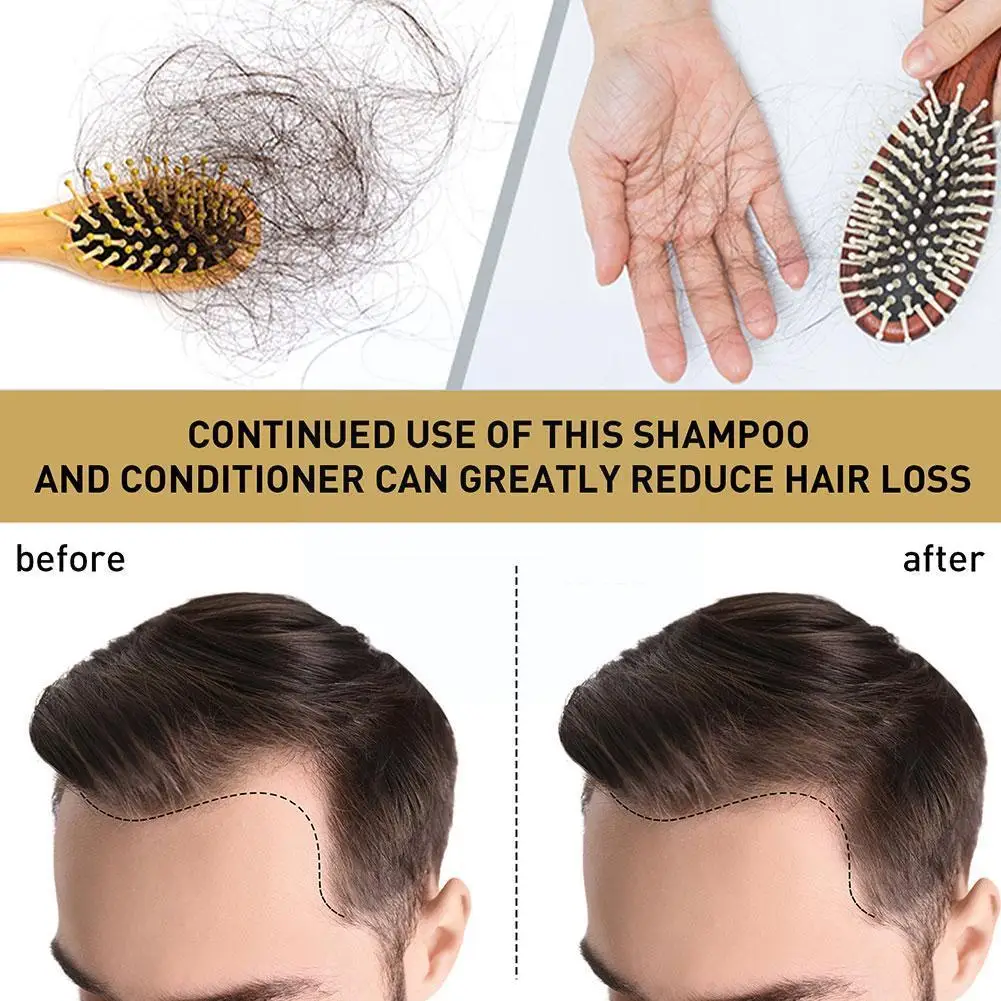 Ginger Essence Shampoo Anti Ha - Hair Care Dandruff のレビューと価格
