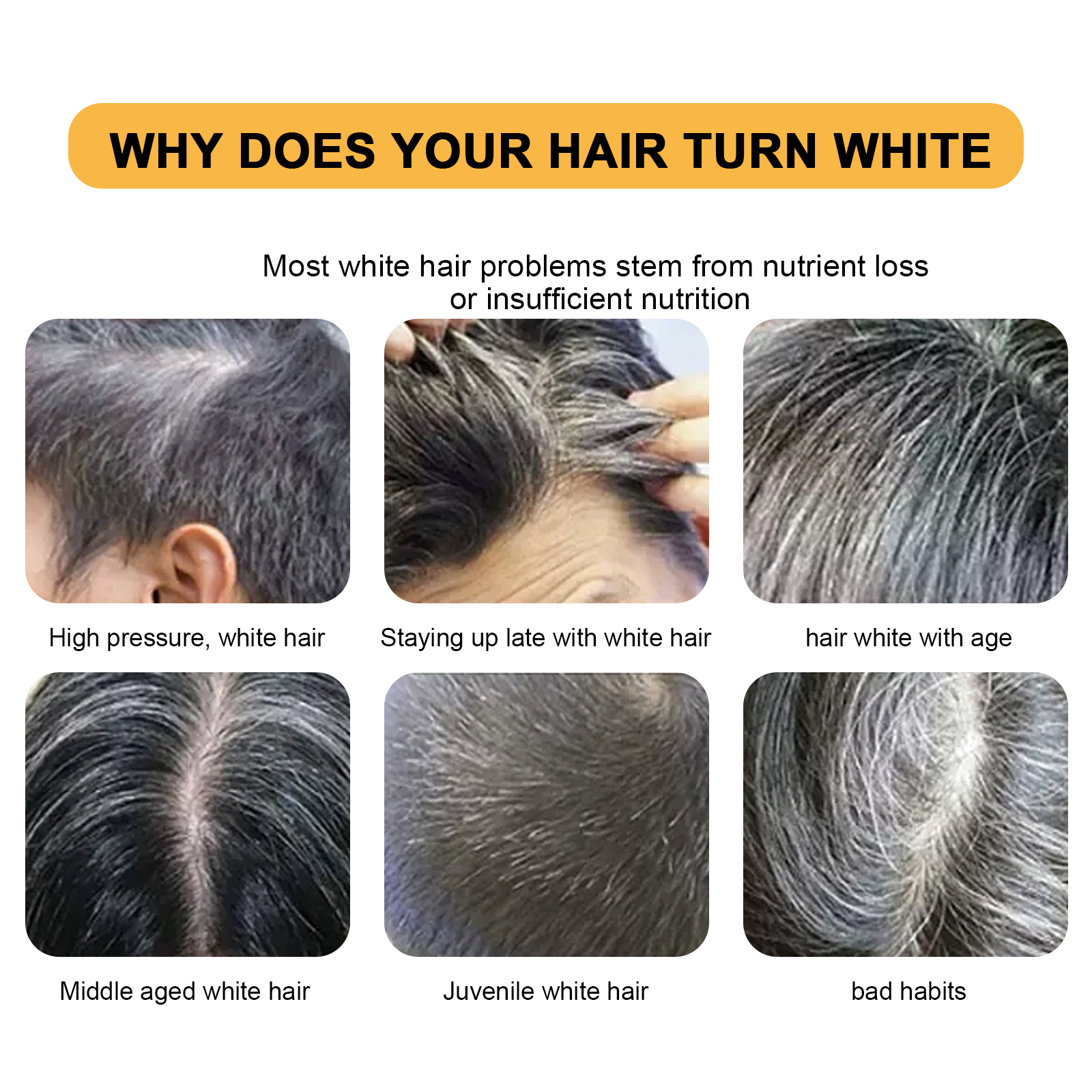 Hair Shampoo Soap Polygonum Mu - Hair Care Dandruff のレビューと価格