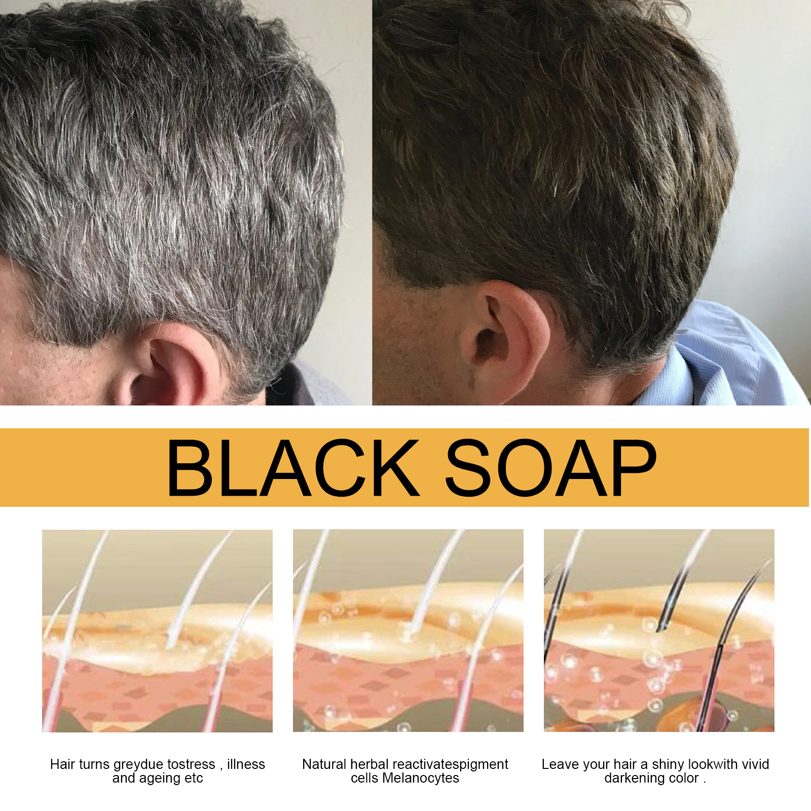 Hair Shampoo Soap Polygonum Mu - Hair Care Dandruff のレビューと価格