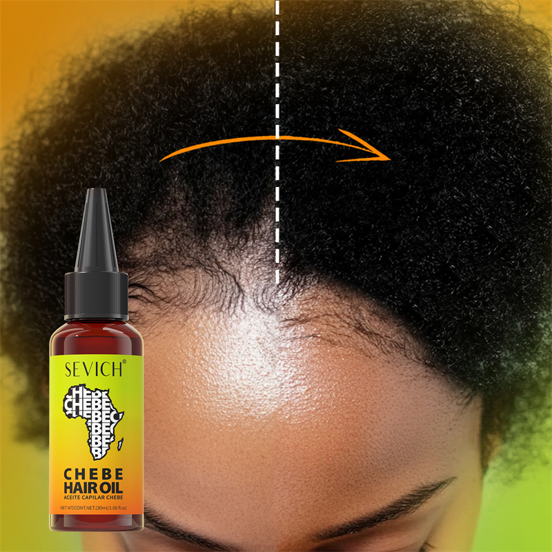Chebe Fast Hair Growth Oil Afr - Hair Care Essence Oil のレビューと価格