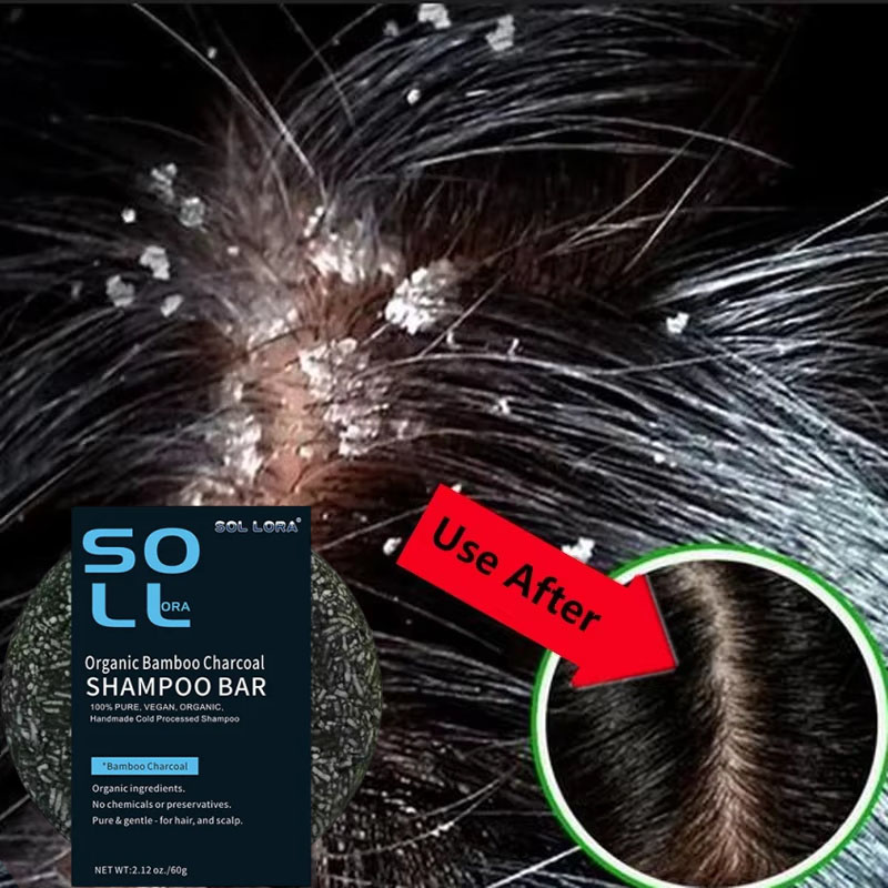 Fast Anti Dandruff Hair Treatm - Hair Care Dandruff のレビューと価格