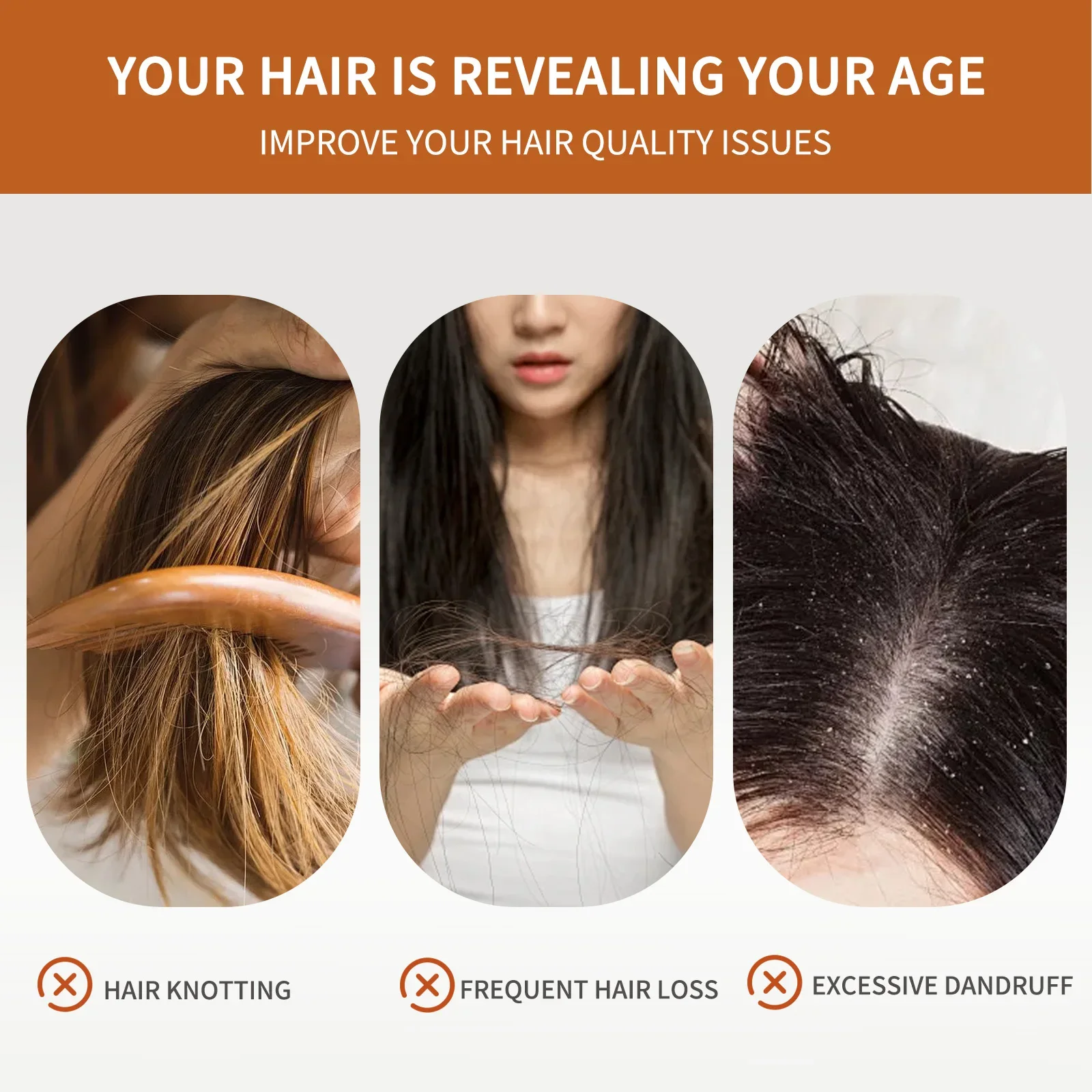 4 Bars of Anti-Hair Loss Shamp - Rosemary Hair Oil のレビューと価格