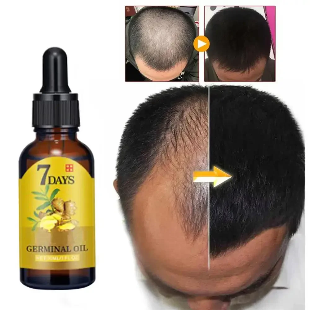 Hair Growth Ginger Fast Growin - Hair Care Essence Oil のレビューと価格