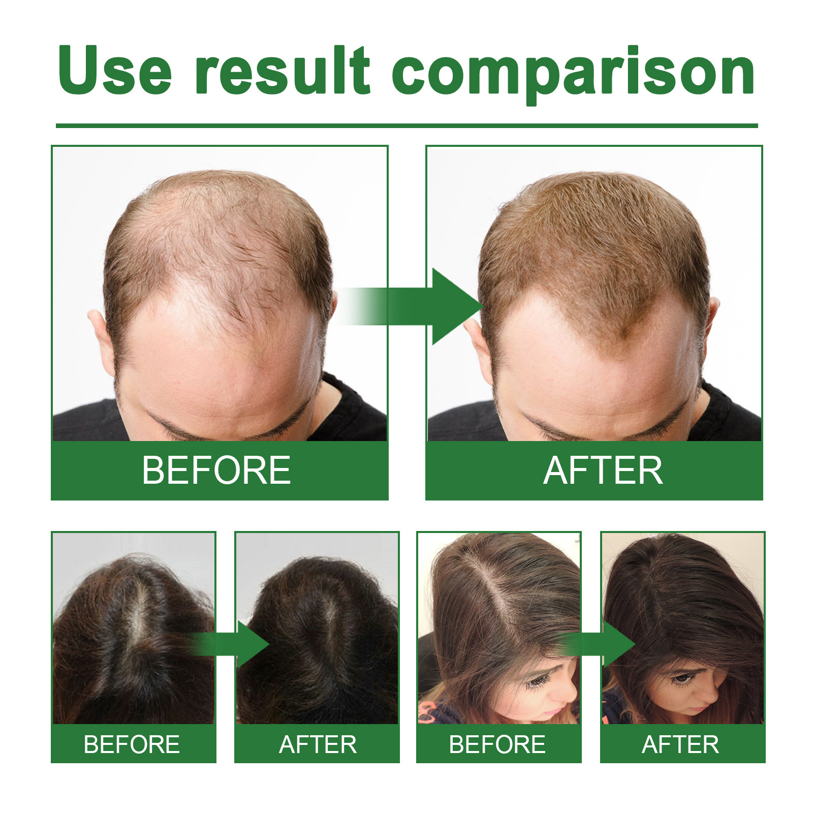 Rosemary Spray for Hair Nouris - Hair Care Growth のレビューと価格