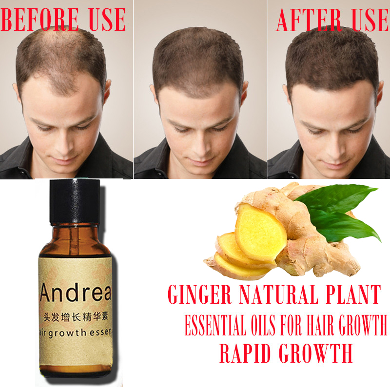 2/5/10Pcs Andrea Hair Growth S - Hair Care Essence Oil のレビューと価格