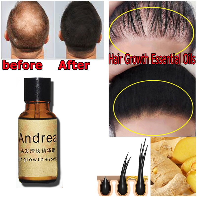 2/5/10Pcs Andrea Hair Growth S - Hair Care Essence Oil のレビューと価格