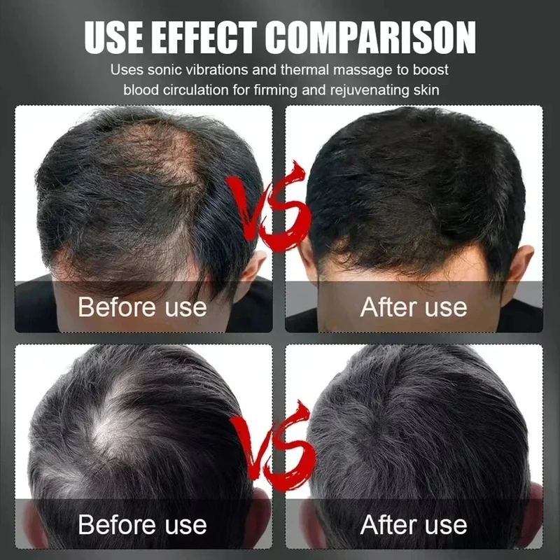 660nm 850nm Red Light Infrared - Hair Care Growth のレビューと価格